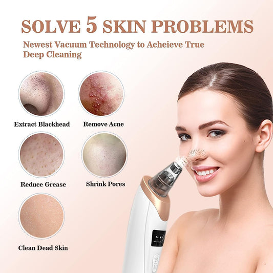 5 in 1 Blackhead Remover machine Pore Vacuum- Electric Facial Pore Cleaner