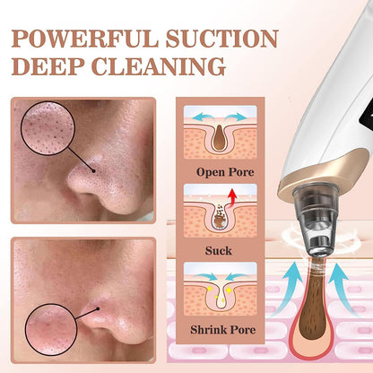 5 in 1 Blackhead Remover machine Pore Vacuum- Electric Facial Pore Cleaner